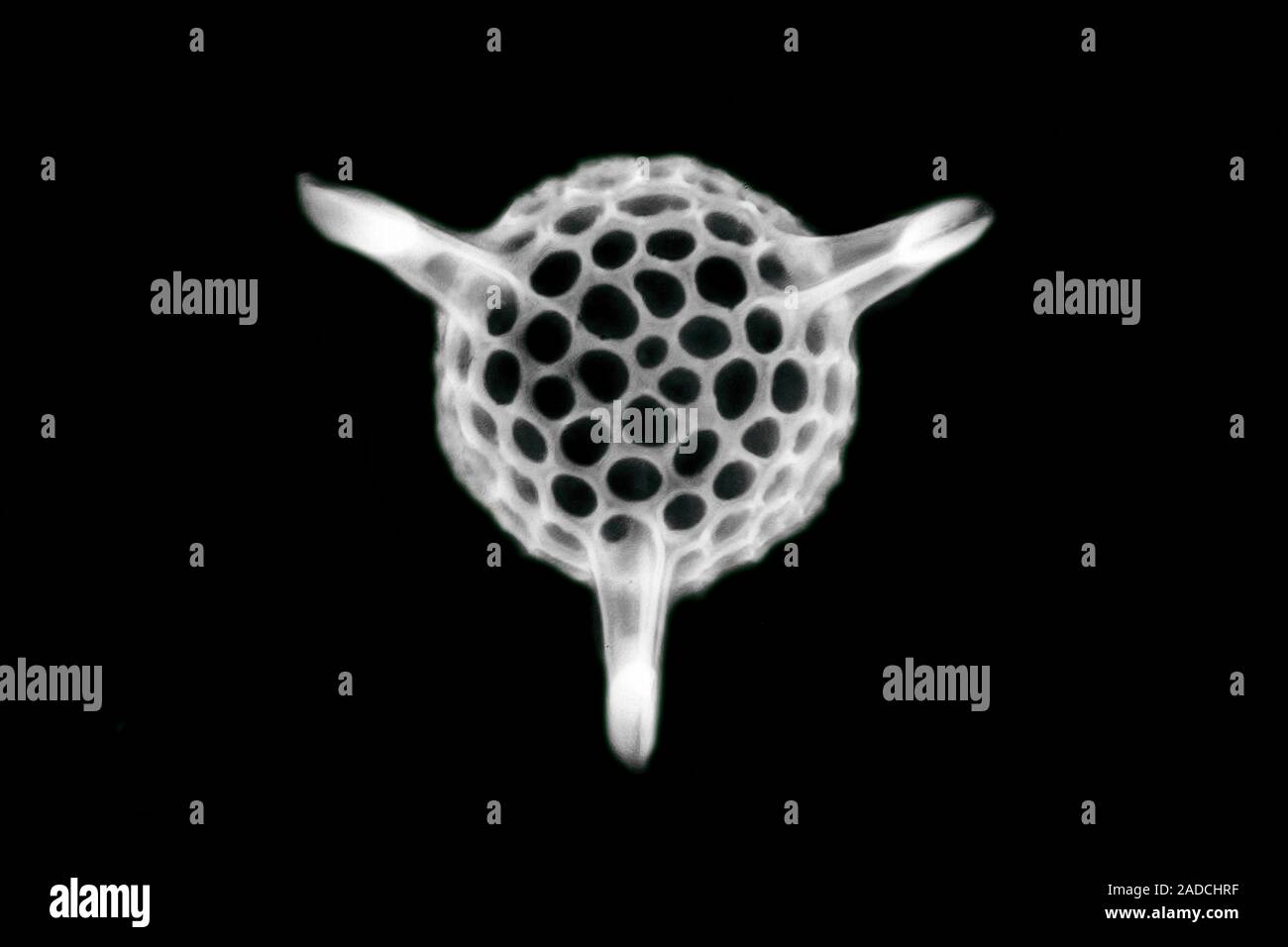 Radiolarian. Light micrograph of a single shell of a radiolarian