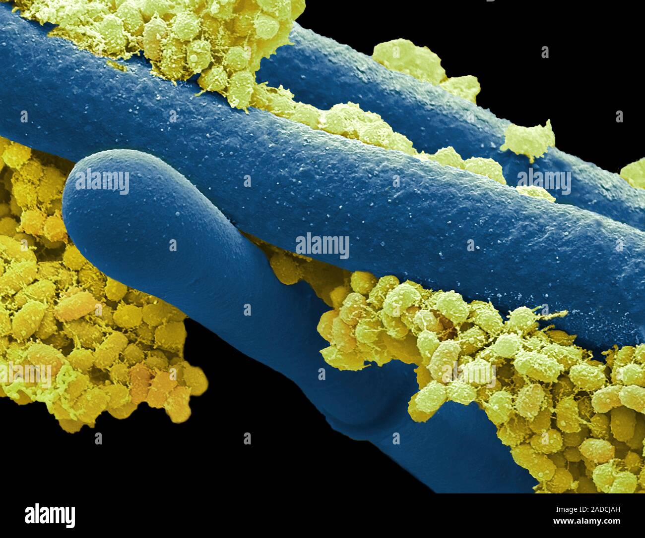 Camembert rind, coloured scanning electron micrograph (SEM). Mesophilic