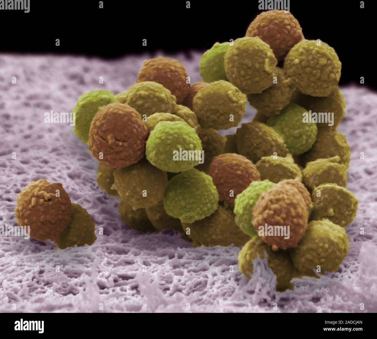 Staphylococcus epidermidis bacteria. Coloured scanning electron ...