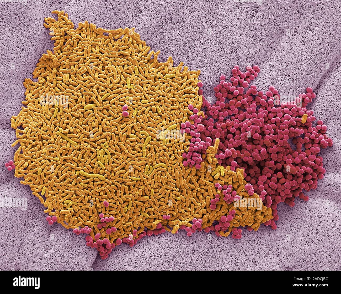 Foot bacteria. Scanning electron micrograph (SEM) of bacteria that live