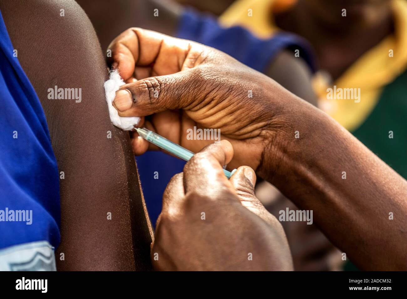 Tetanus Arm Example Tetanus vaccine being injected into a schoolgirl's upper arm. Several ...