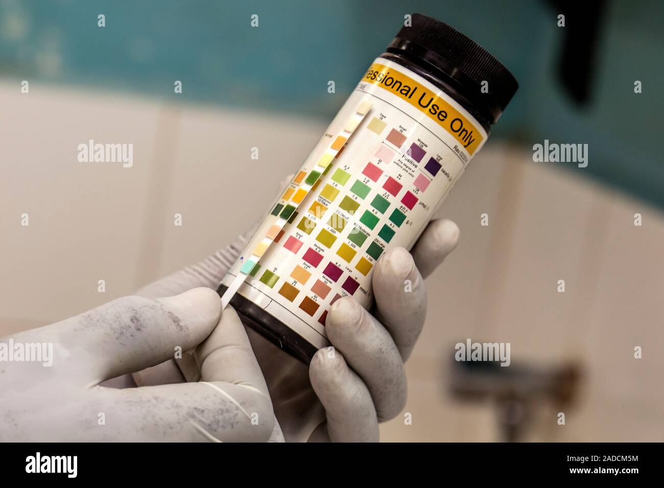 Urine test results. Gloved hand of a doctor holding a dipstick that has