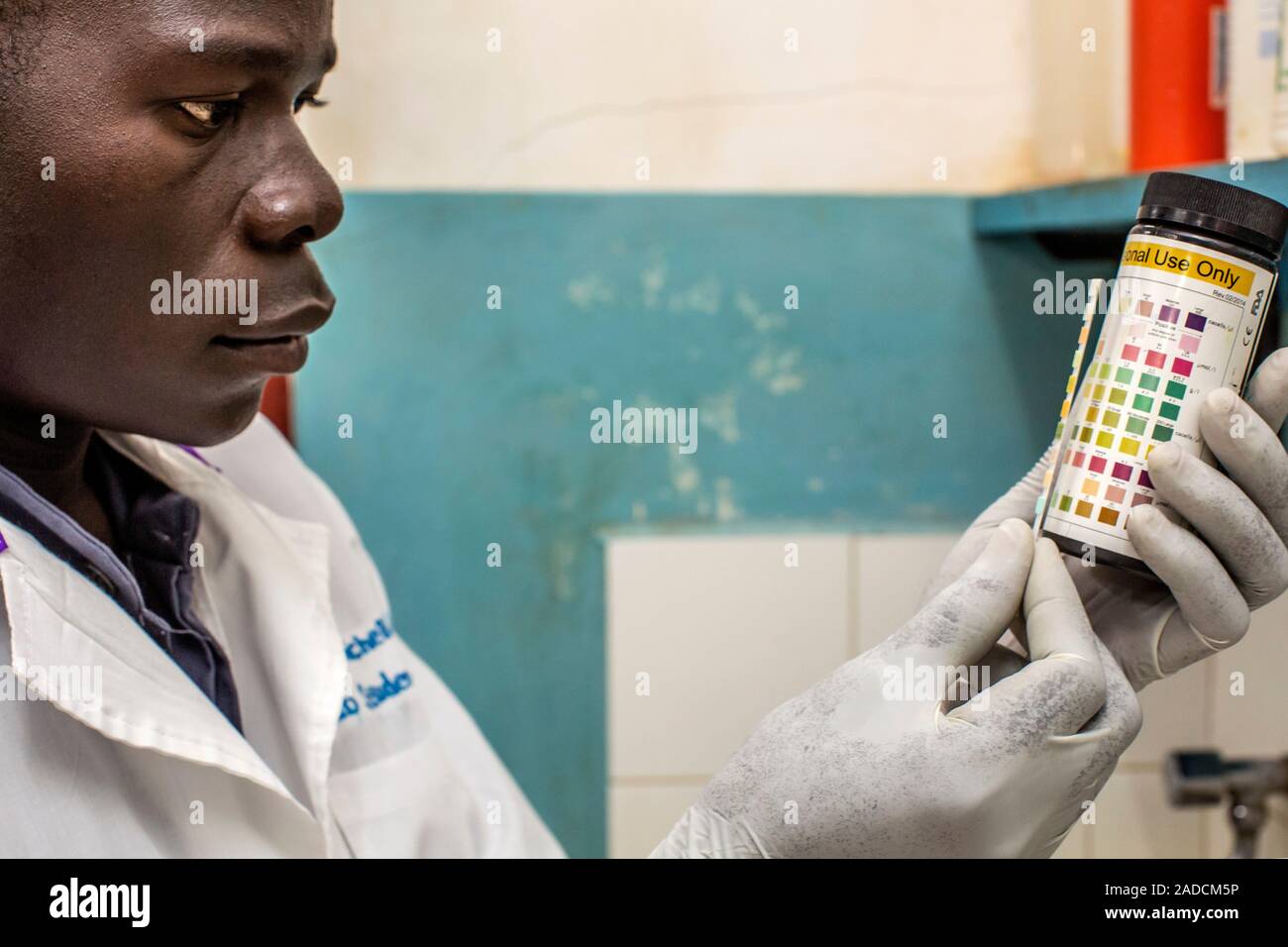 Urine test results. Doctor holding a dipstick that has been immersed in