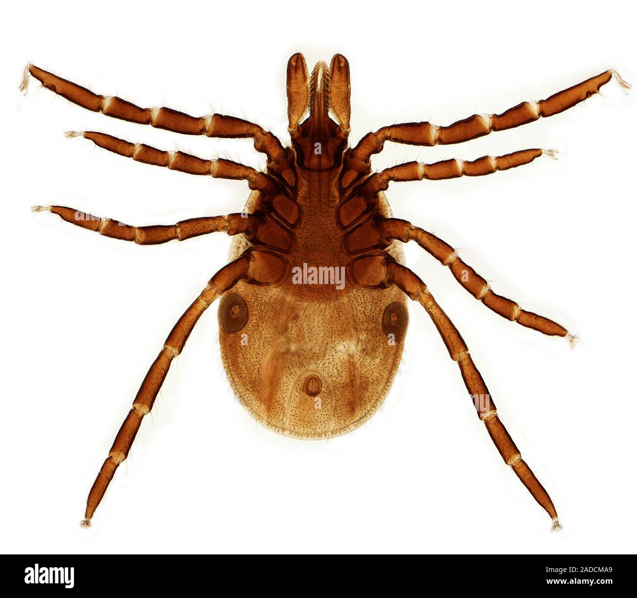 Light micrograph (LM) of a female Ixodes ricinus tick, the principal ...