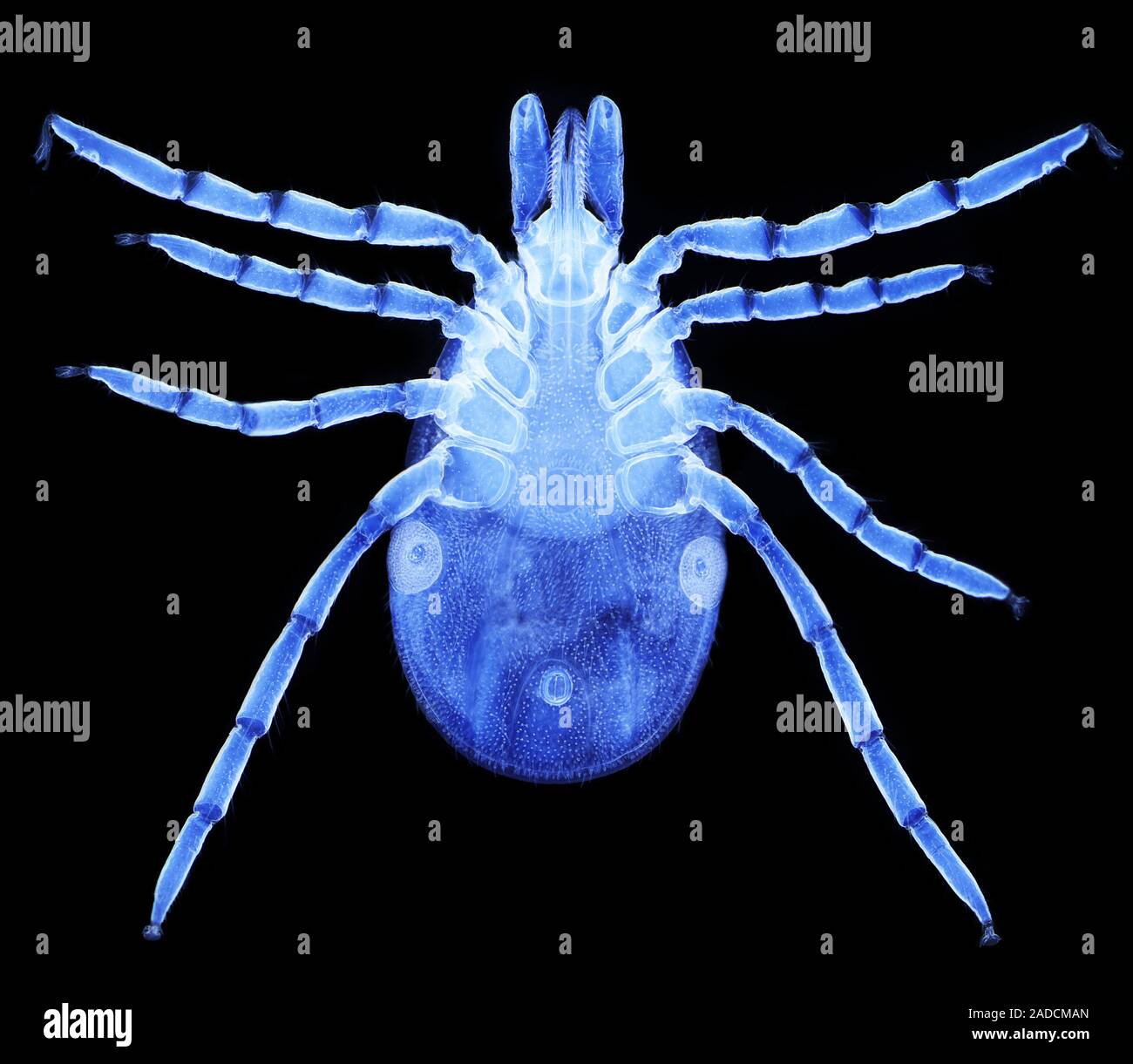 Female Lyme disease tick. Light micrograph (LM) of a female Ixodes
