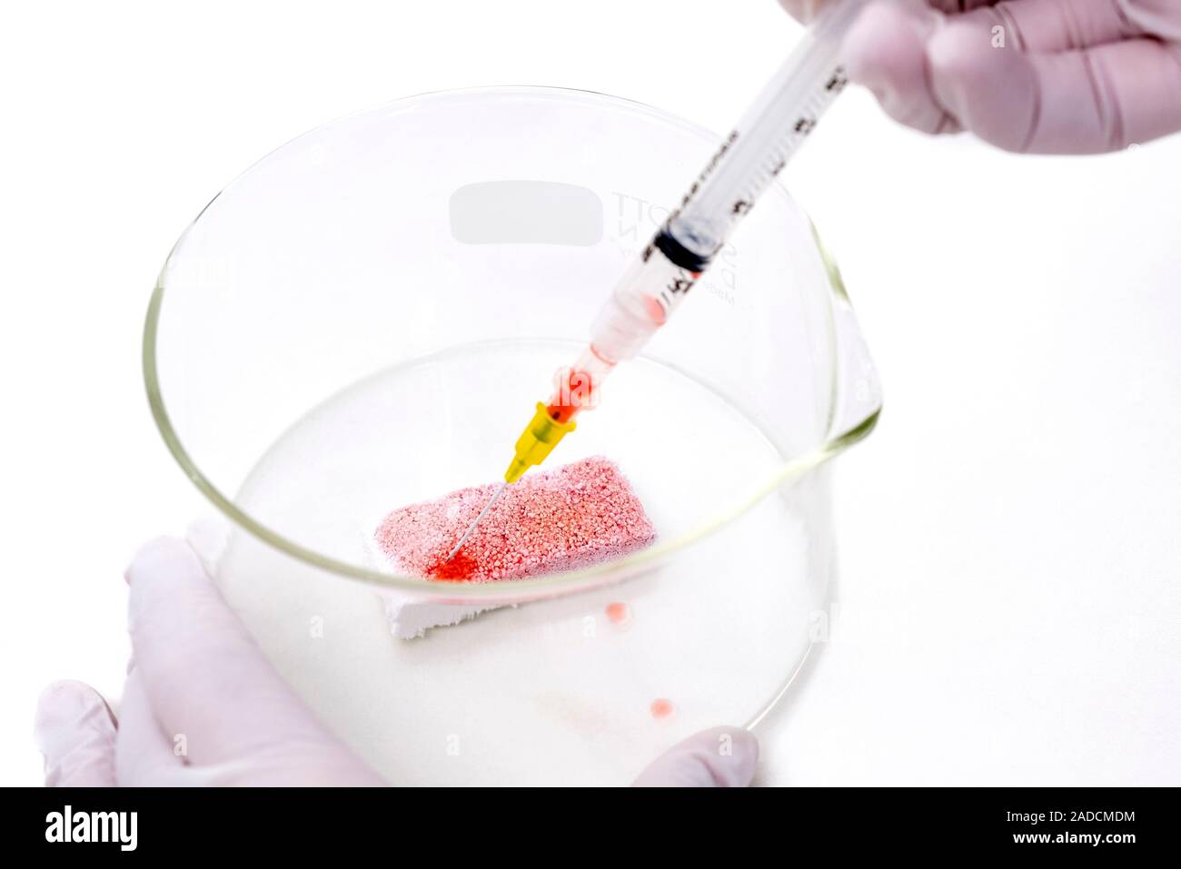 Collagen sponge. Person injecting a collagen sponge with a fluid (red