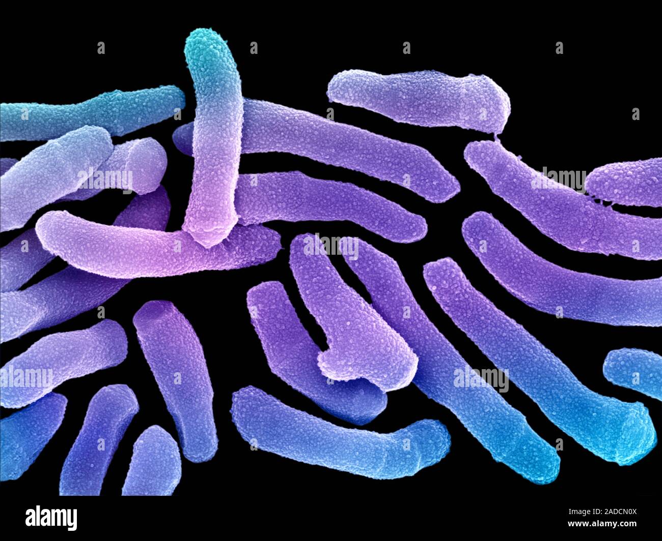Пропионовокислых бактерий. Пропионовокислые бактерии. Пропионовокислые пробиотики. Пропионовокислые бактерии. Пропионовокислые бактерии propionibacterium freudenreichii.