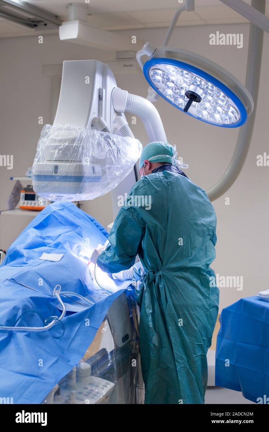 Implantable defibrillator surgery. Surgeon carrying out surgery to fit