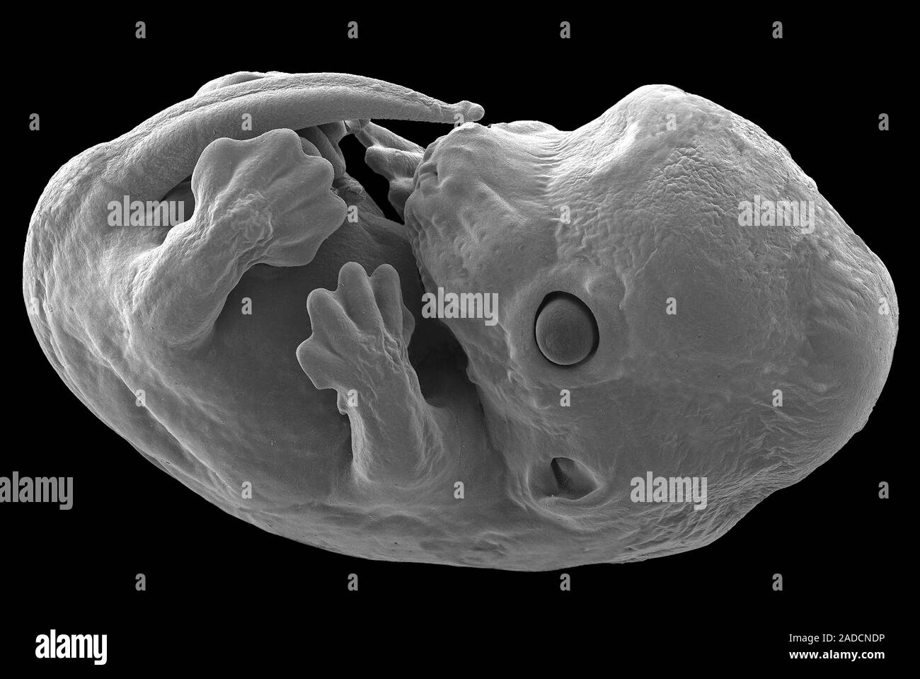 Mouse foetus. Scanning electron micrograph (SEM) of a 23-day-old mouse ...