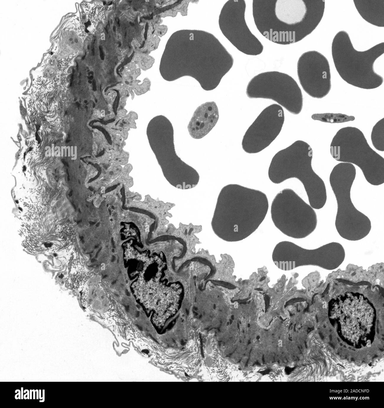Artery. Transmission electron micrograph (TEM) of a transverse section ...
