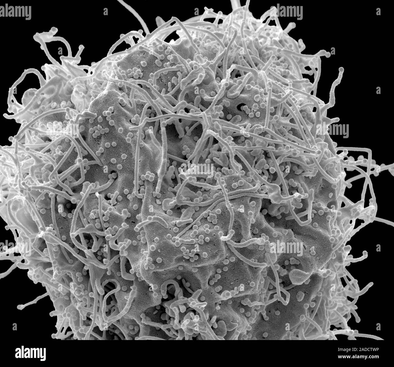 HIV infected 293T cell. Scanning electron micrograph (SEM) of a 293T