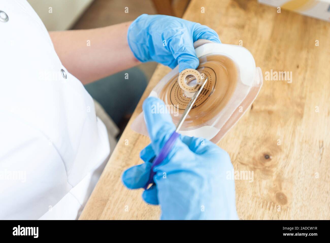 Home care nursing. Nurse preparing a colostomy bag in a patient's home