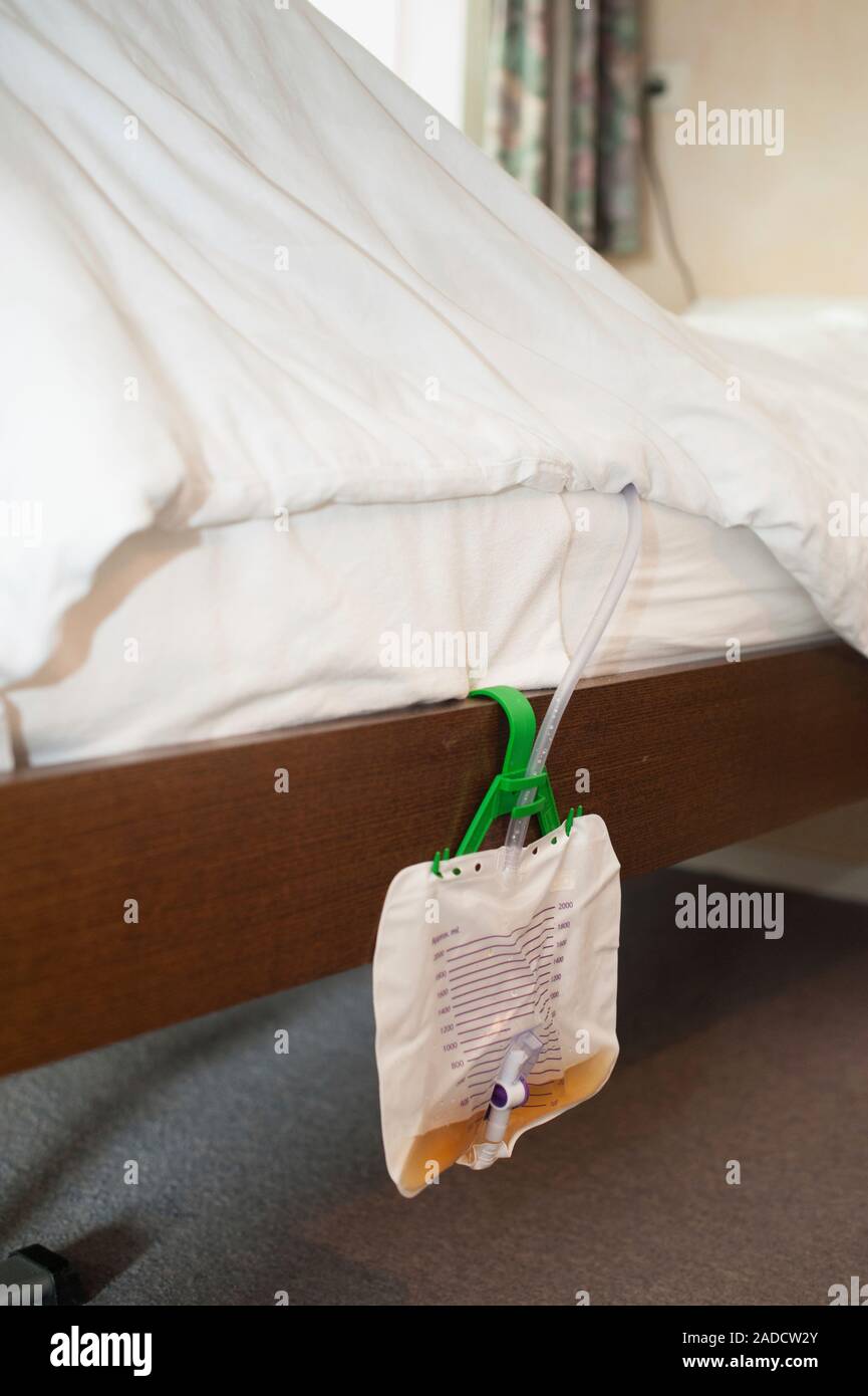 Catheter bag. Closeup of a catheter bag attached to the side of a