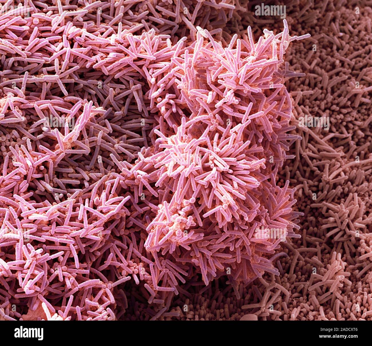 Plaqueforming bacteria, coloured scanning electron micrograph (SEM