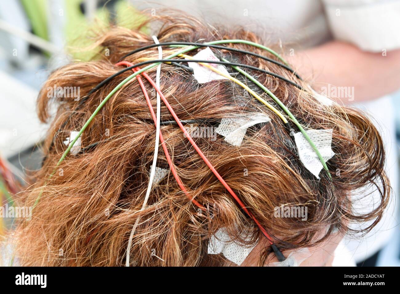 Electroencephalography electrodes attached to a woman's scalp. The