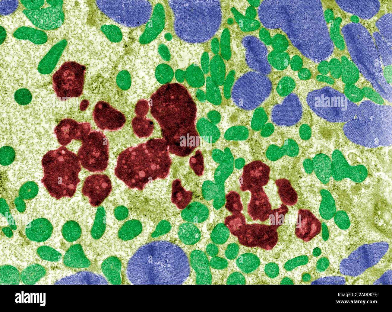 Coloured transmission electron micrograph (TEM) showing large ...