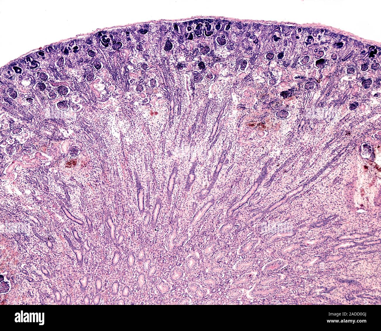 Kidney lobule of a 20 weeks foetus showing a cortex and medulla well ...