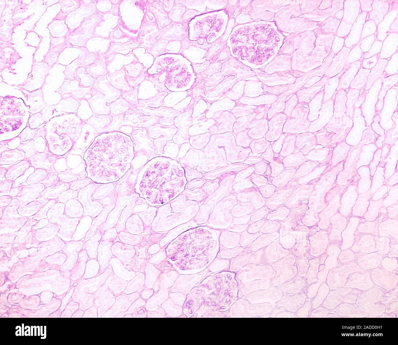 Pas Micrograph Light micrograph of a section of human kidney stained with PAS ...