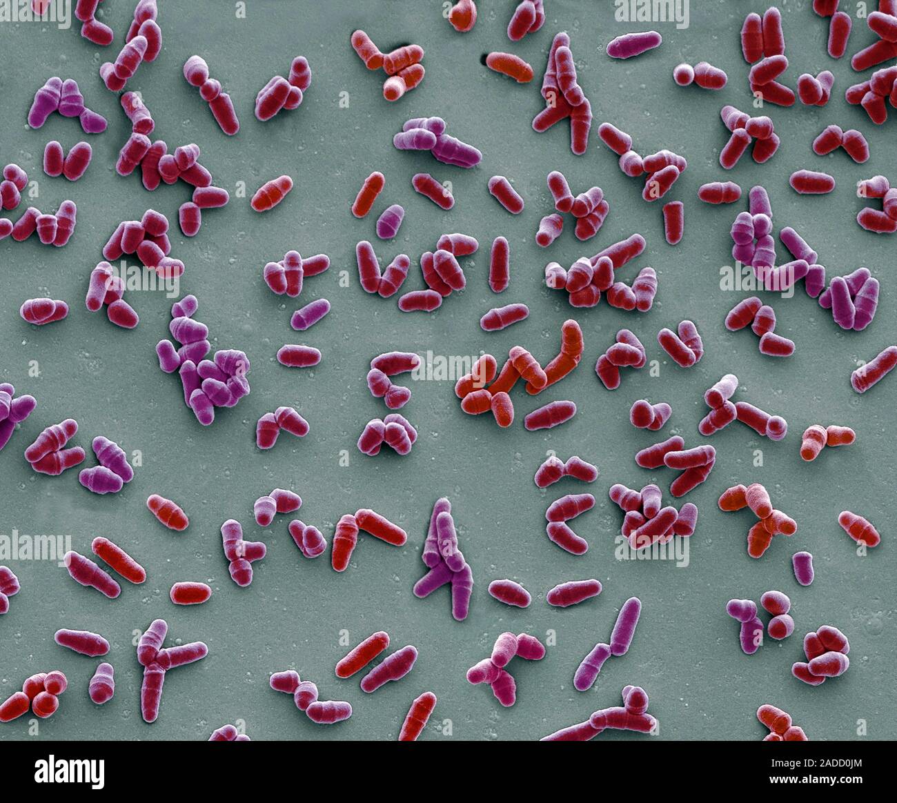 Dividing yeast cells. Coloured scanning electron micrograph (SEM) of