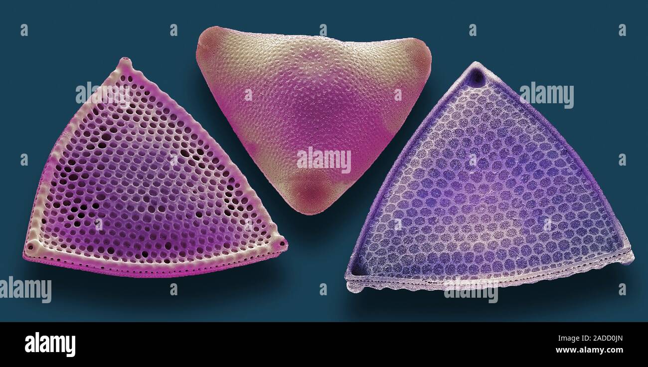 Diatoms. Coloured scanning electron micrograph (SEM) of diatoms ...