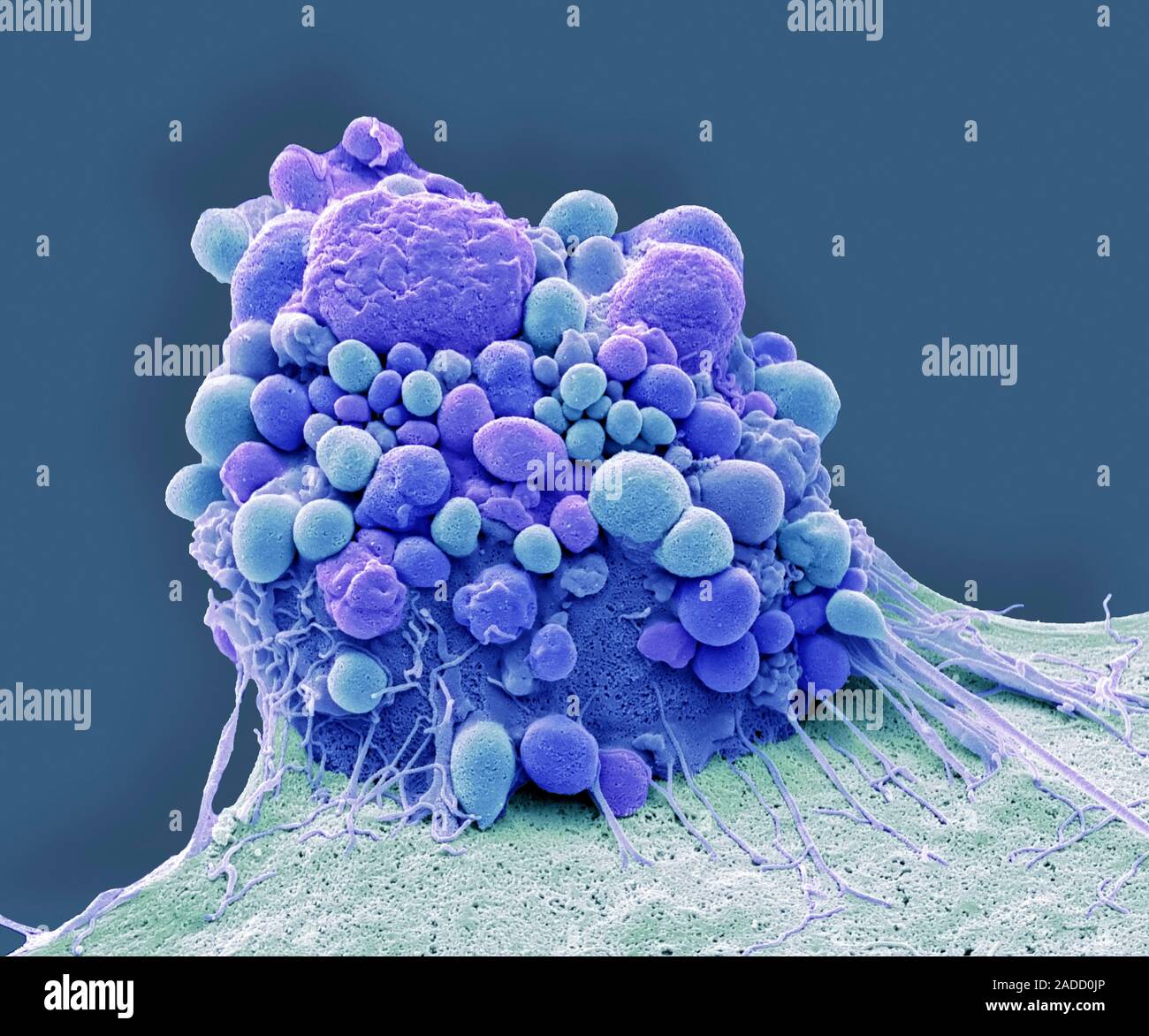 Apoptosis. Coloured scanning electron micrograph (SEM) of a brain ...