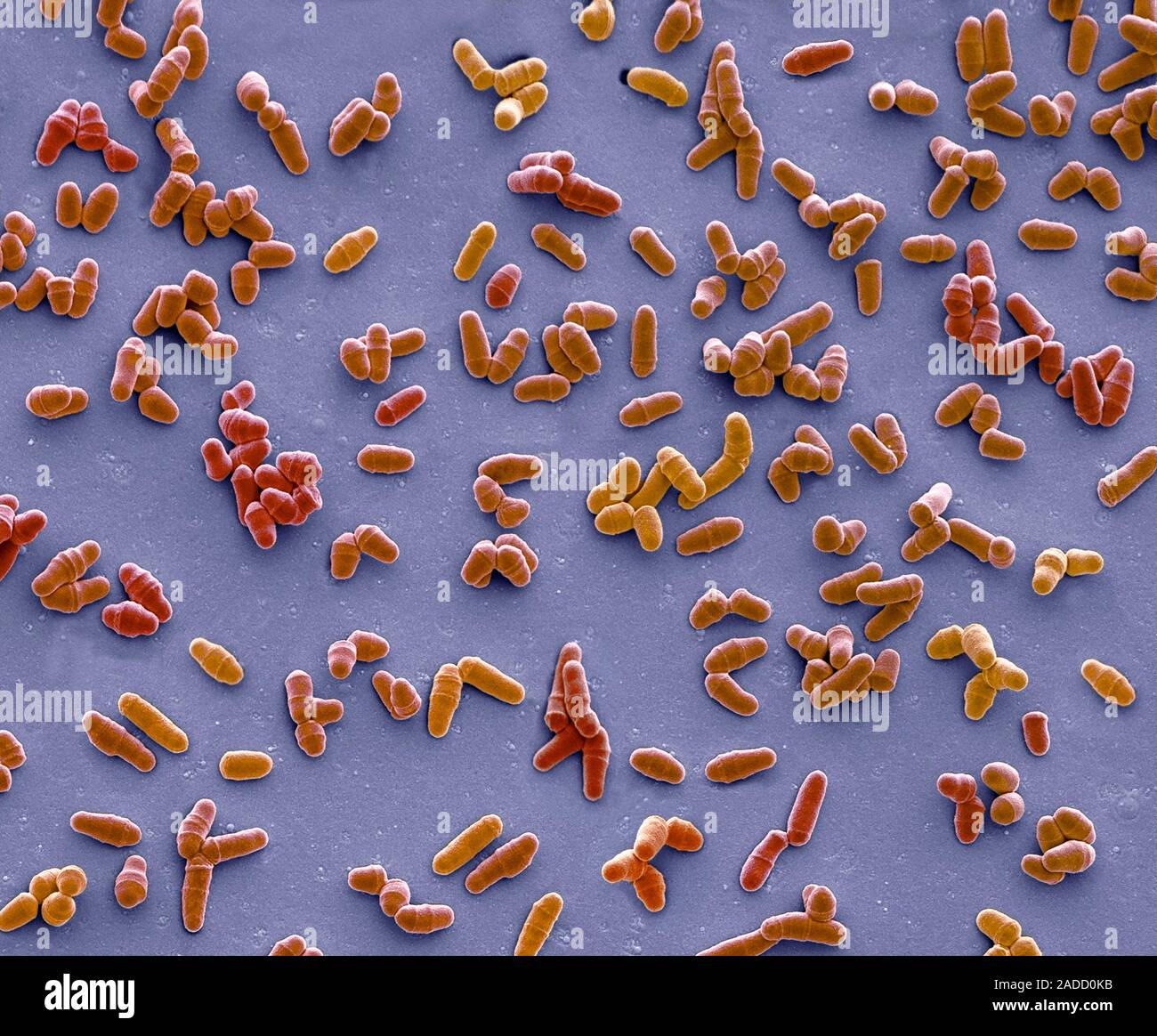 Dividing yeast cells. Coloured scanning electron micrograph (SEM) of