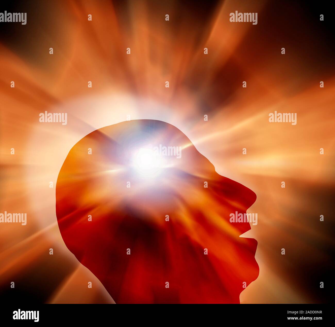 Head pain, illustration Stock Photo Alamy