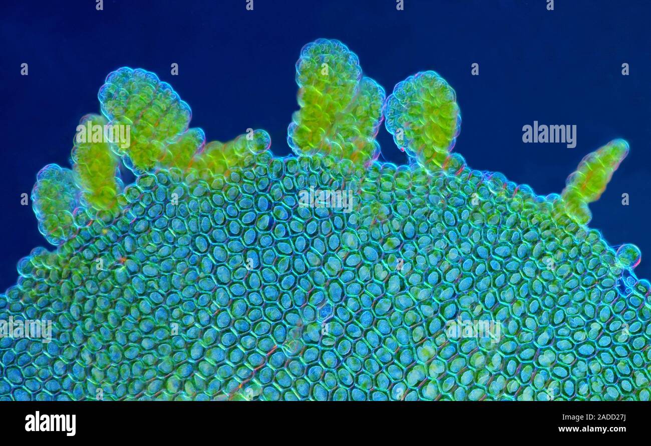 Liverwort Leaf Polarised Light Micrograph Of A Section Through A Leaf From A Liverwort Plant