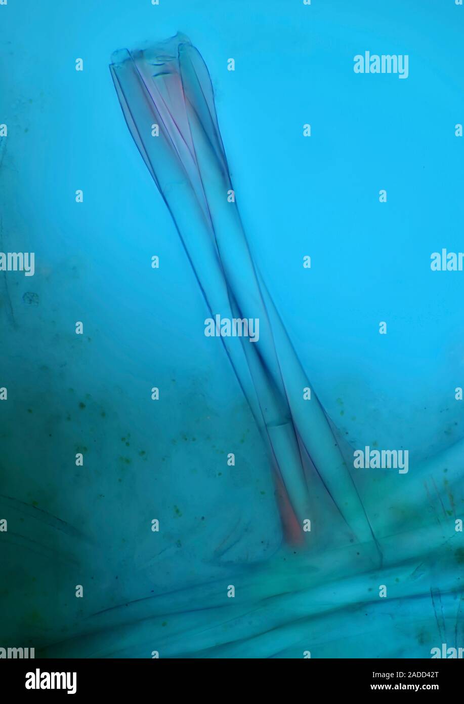 Sponge spicules, polarized light micrograph. Sponges are simple