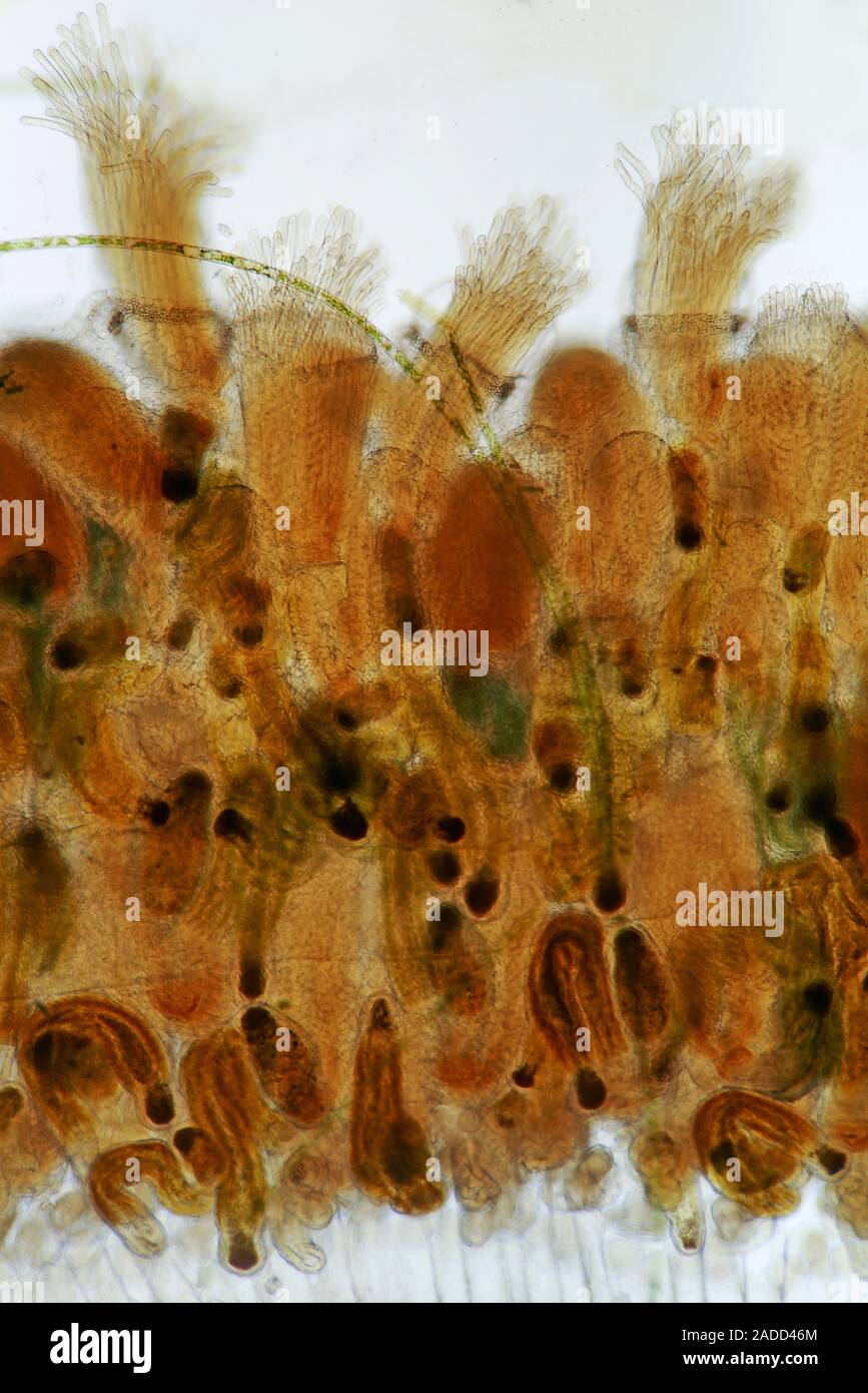 Bryozoan colony, light micrograph. Bryozoans are tiny filterfeeding invertebrate animals that