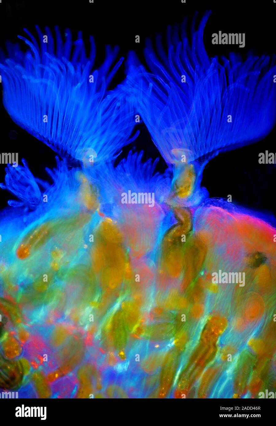 Bryozoans, polarized light micrograph. Bryozoans are tiny filter