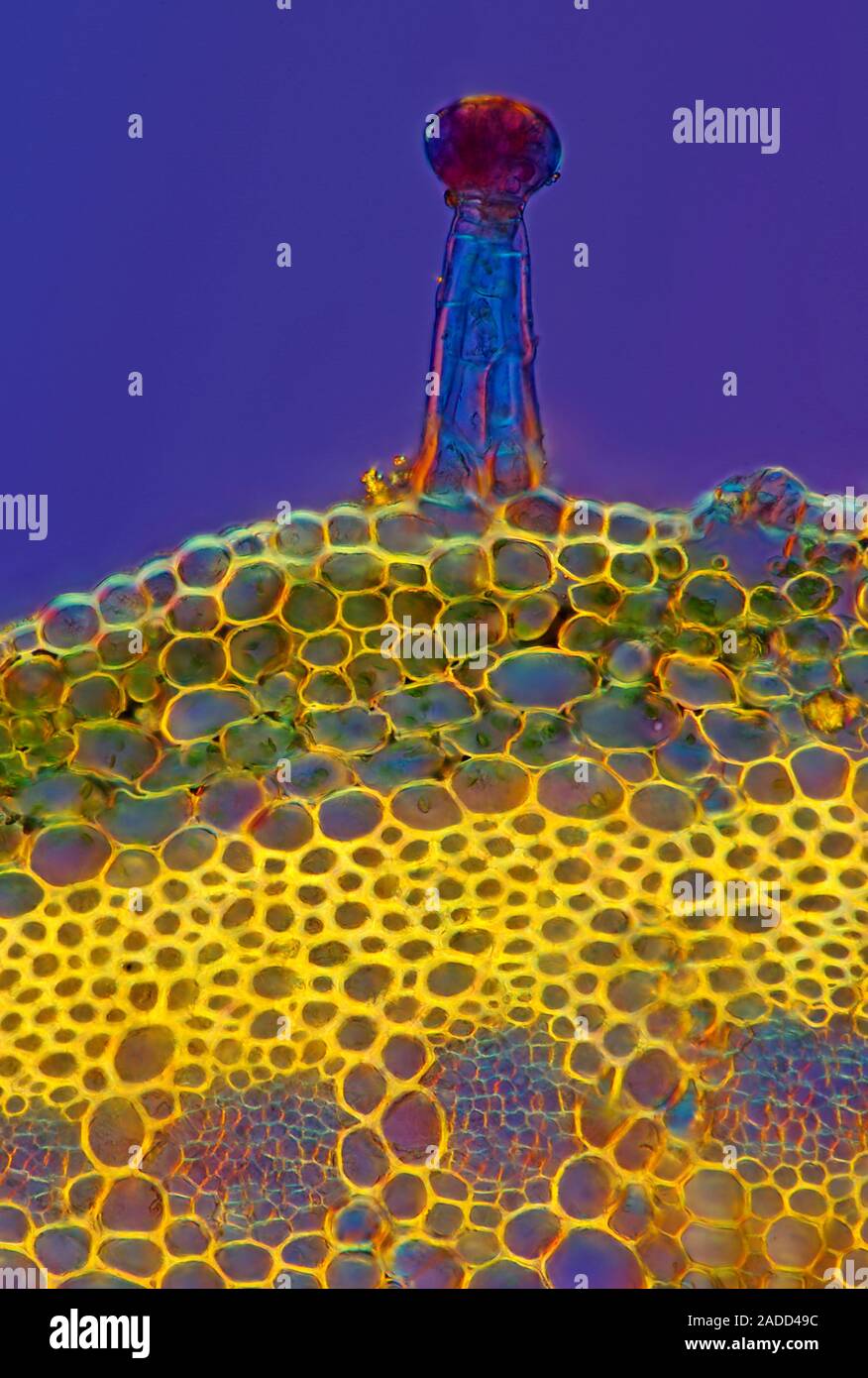 Heuchera plant stalk and trichome crosssection, polarized light