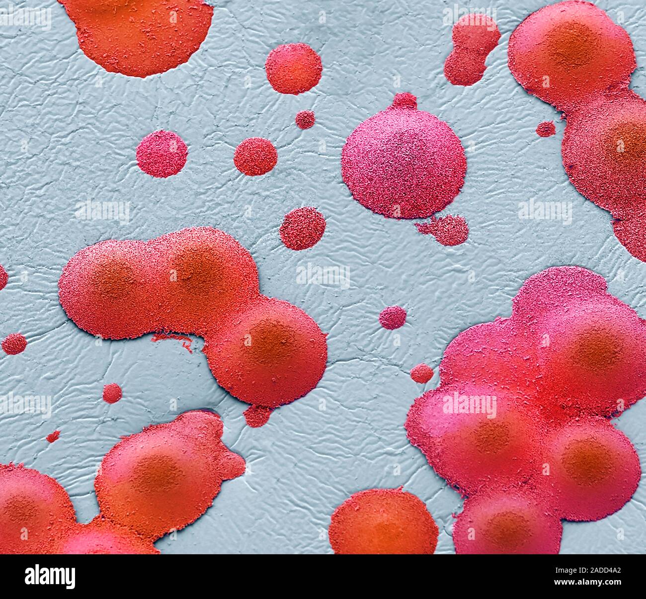 Sputum. Scanning electron micrograph (SEM) of a bacterial culture from ...