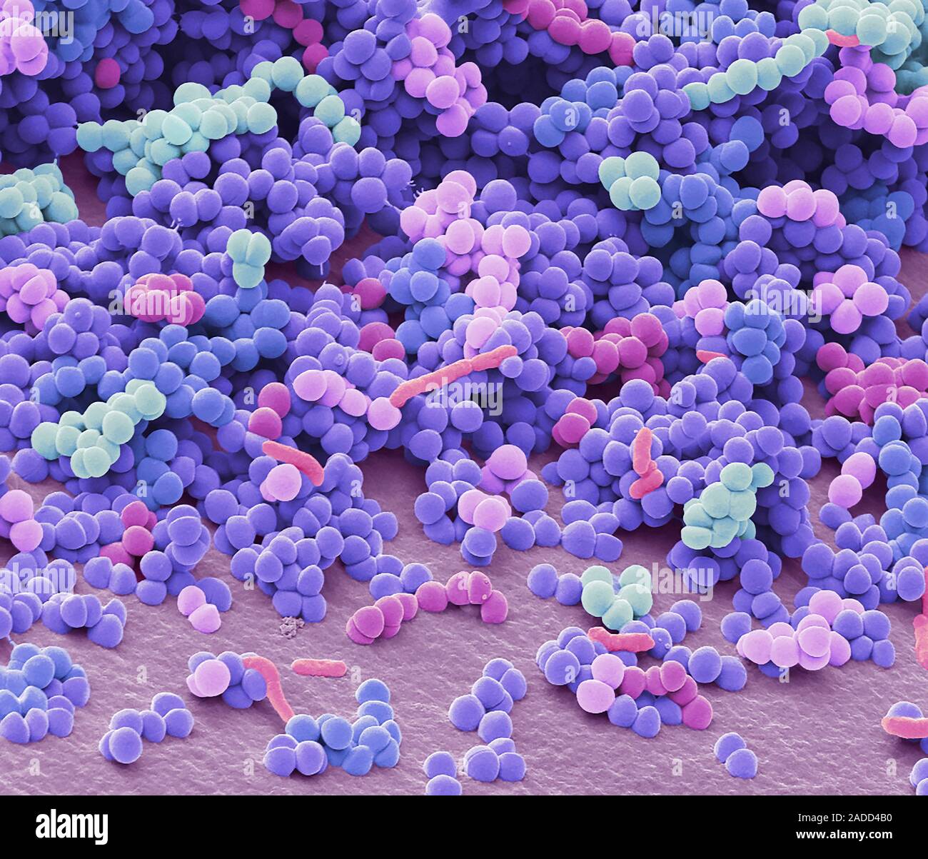 Folliculitis. Coloured scanning electron micrograph (SEM) of bacteria ...