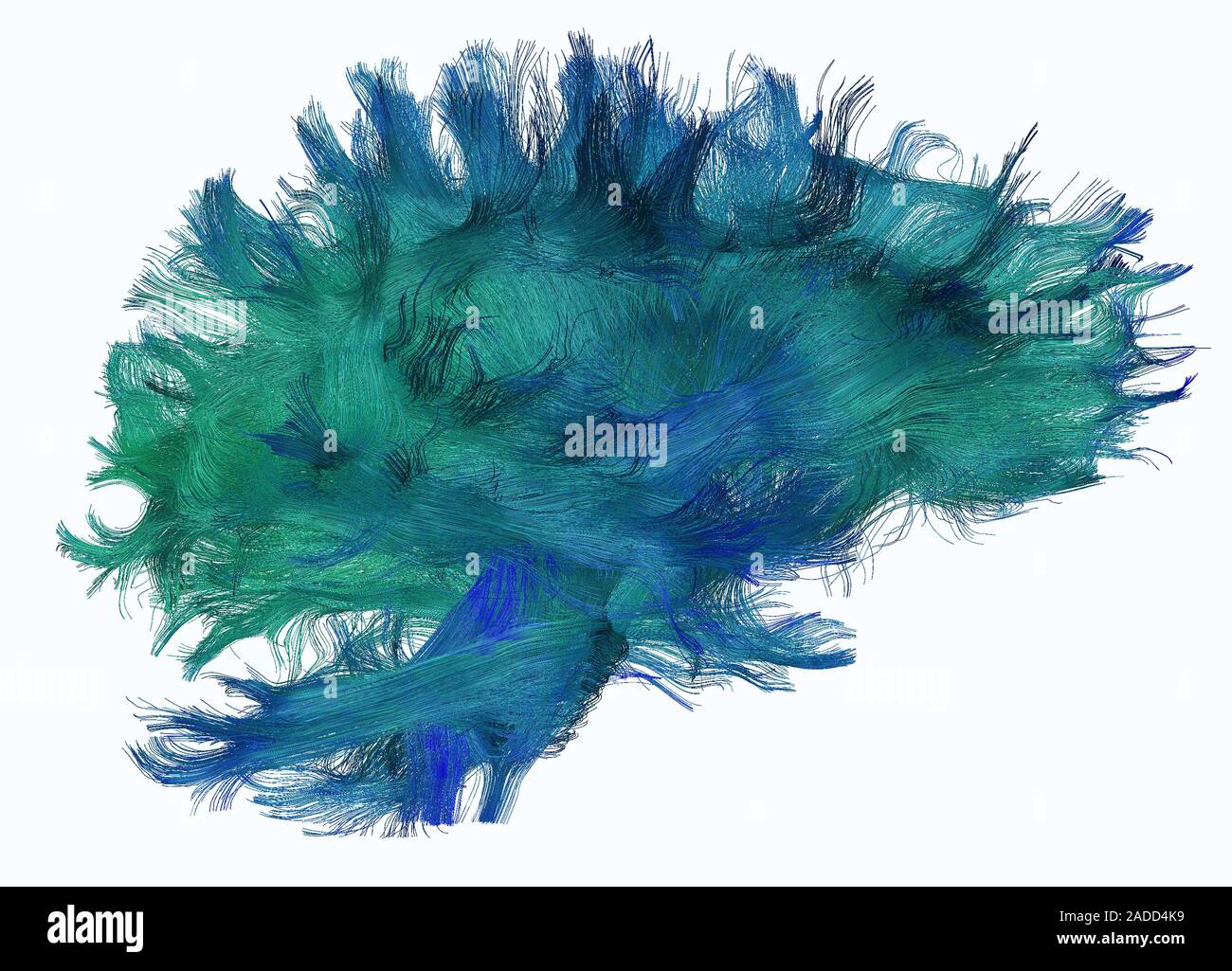 Diffusion tensor imaging (DTI) scan. A close-up look into the reconstructed white matter fibres of the brain. DTI offers a non-invasive look into how Stock Photo