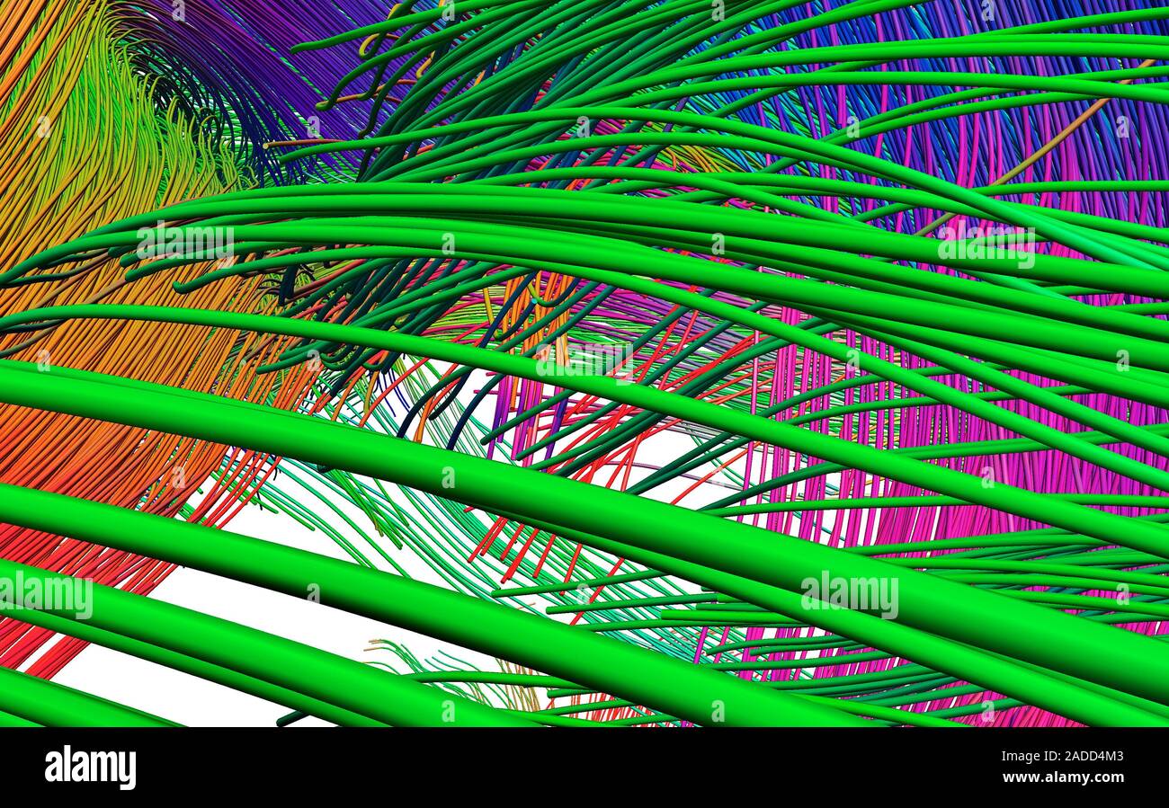 Diffusion tensor imaging (DTI) scan. Shown are the reconstructed white matter fibres of the fornix, a pathway that helps set the tone of our remembere Stock Photo