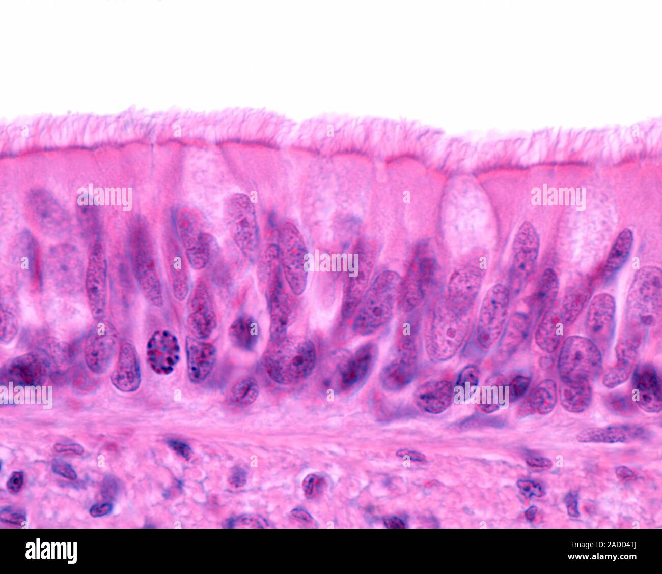 Light micrograph of the mucosa of the trachea. It is lined by a