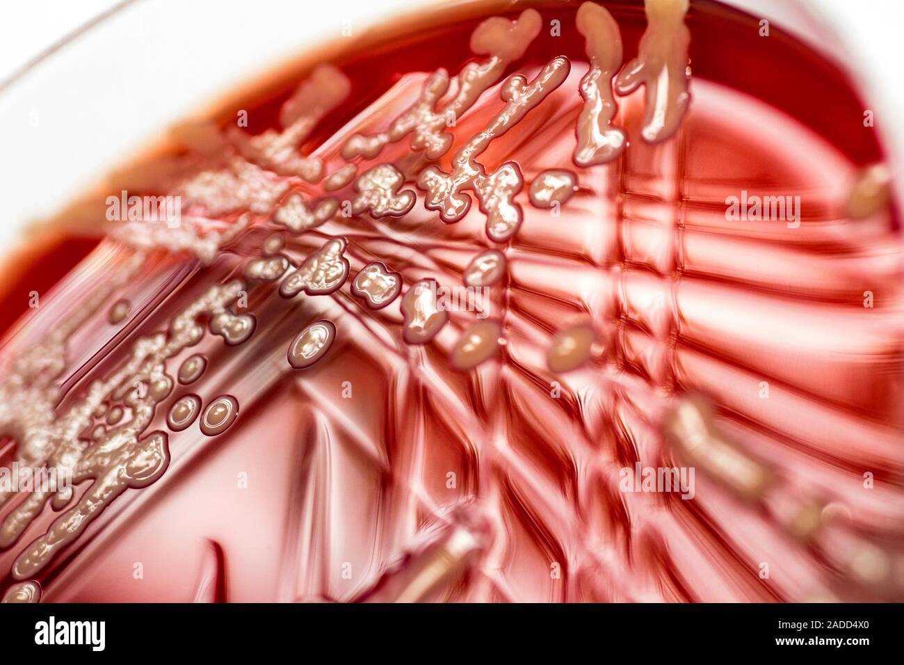 Colonies of Staphylococcus aureus bacteria growing on blood agar in a ...
