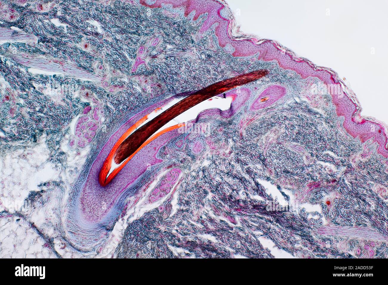Light micrograph of a section of skin showing a hair follicle (centre ...