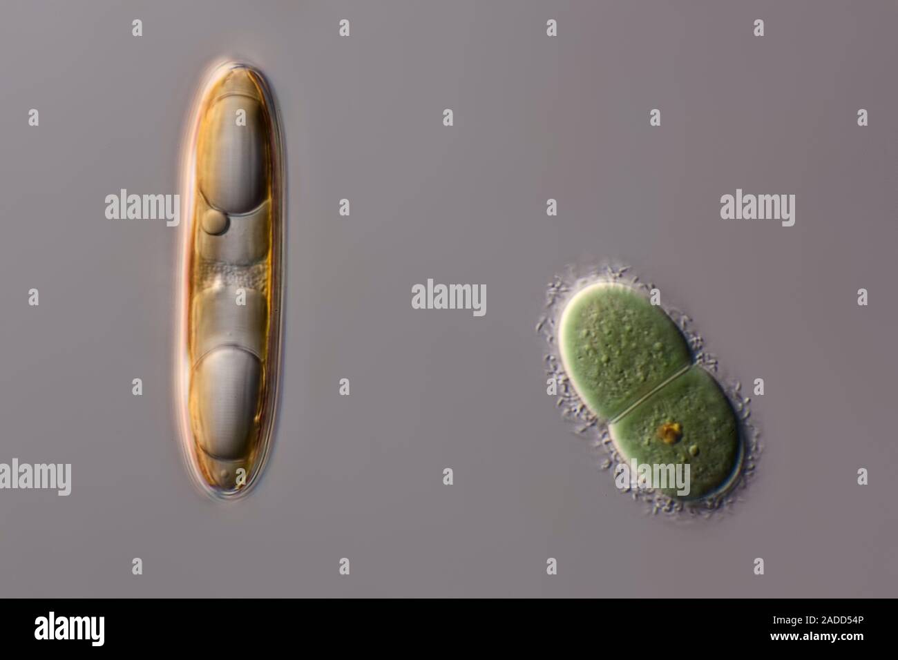 Diatom. Light micrograph of a diatom and a Chroococcus cyanobacterium ...