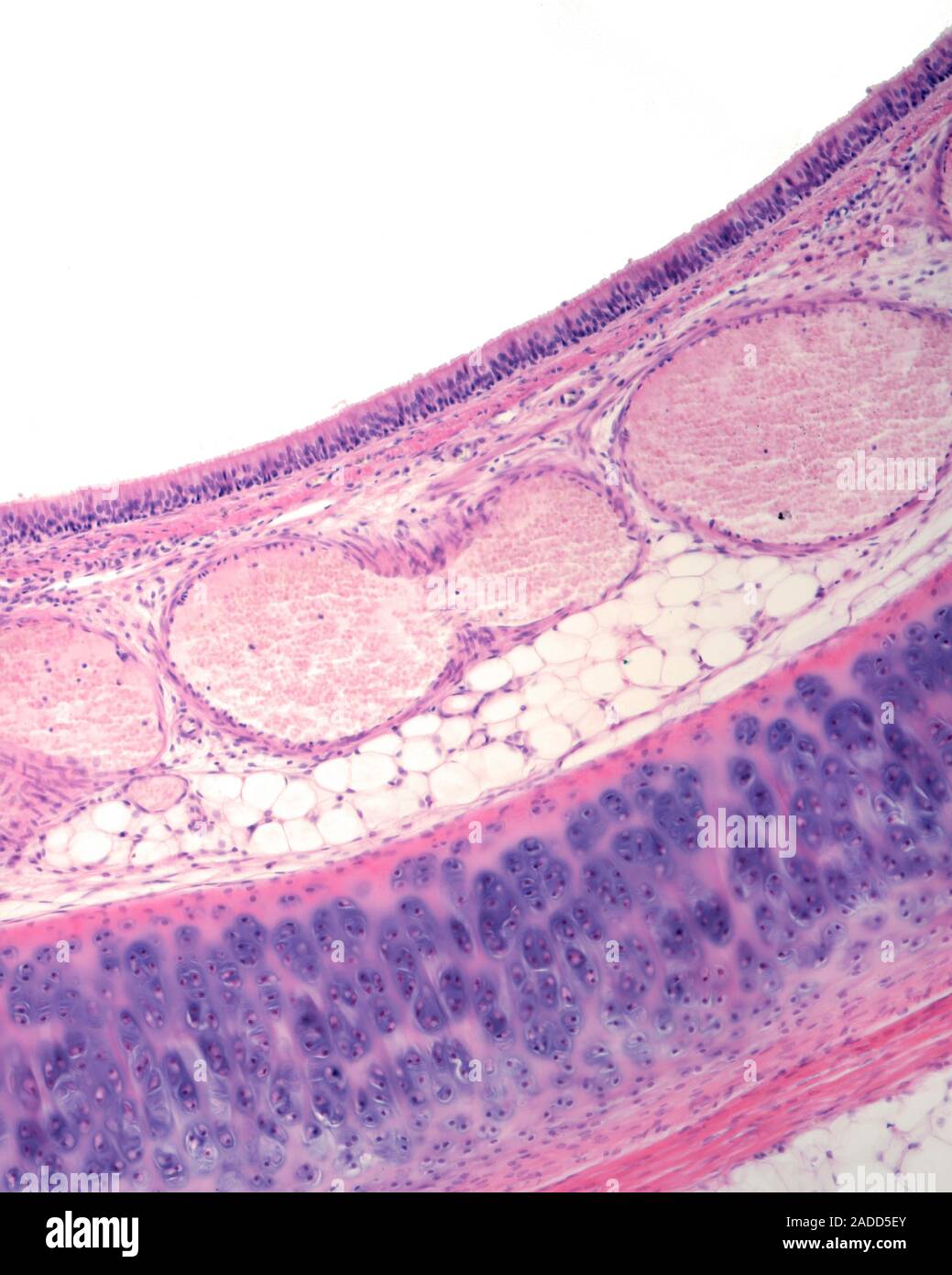 Layers of trachea wall, light micrograph. The uppermost layer is the