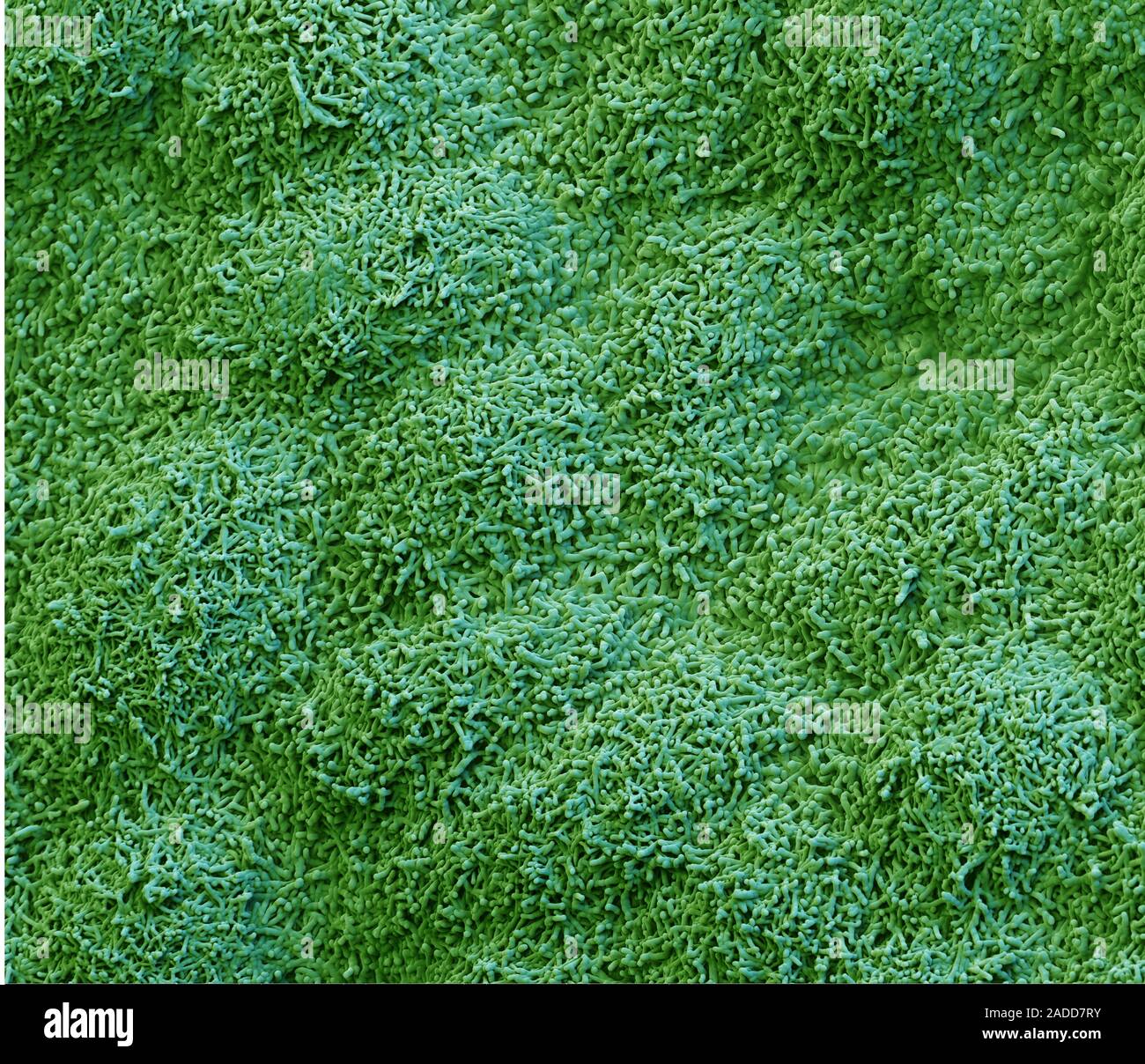 acacia-leaf-surface-coloured-scanning-electron-micrograph-sem-this