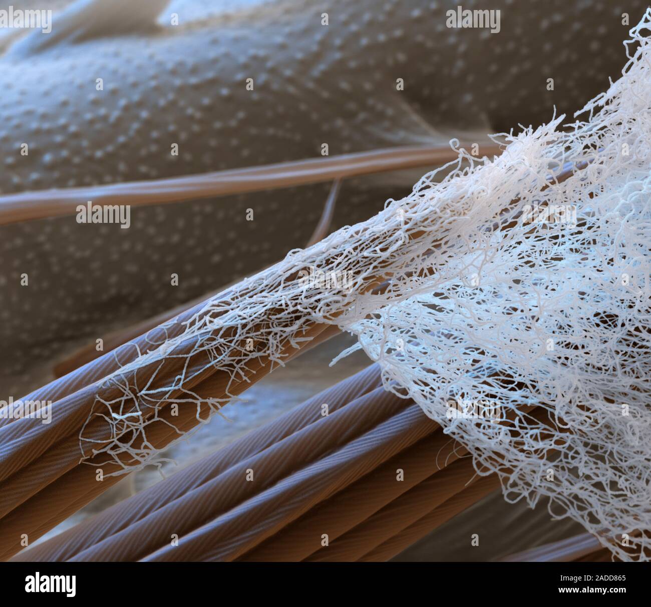 Spider silk on insect prey, coloured scanning electron micrograph (SEM
