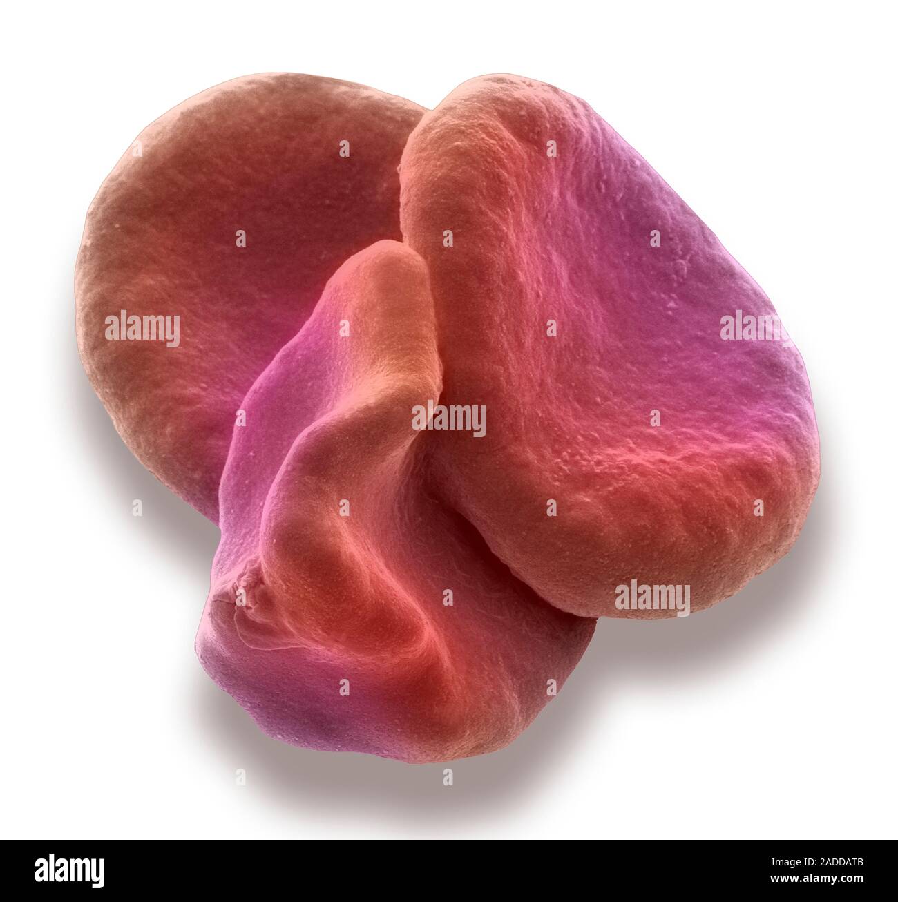 Red blood cells. Coloured scanning electron micrograph (SEM) of red ...