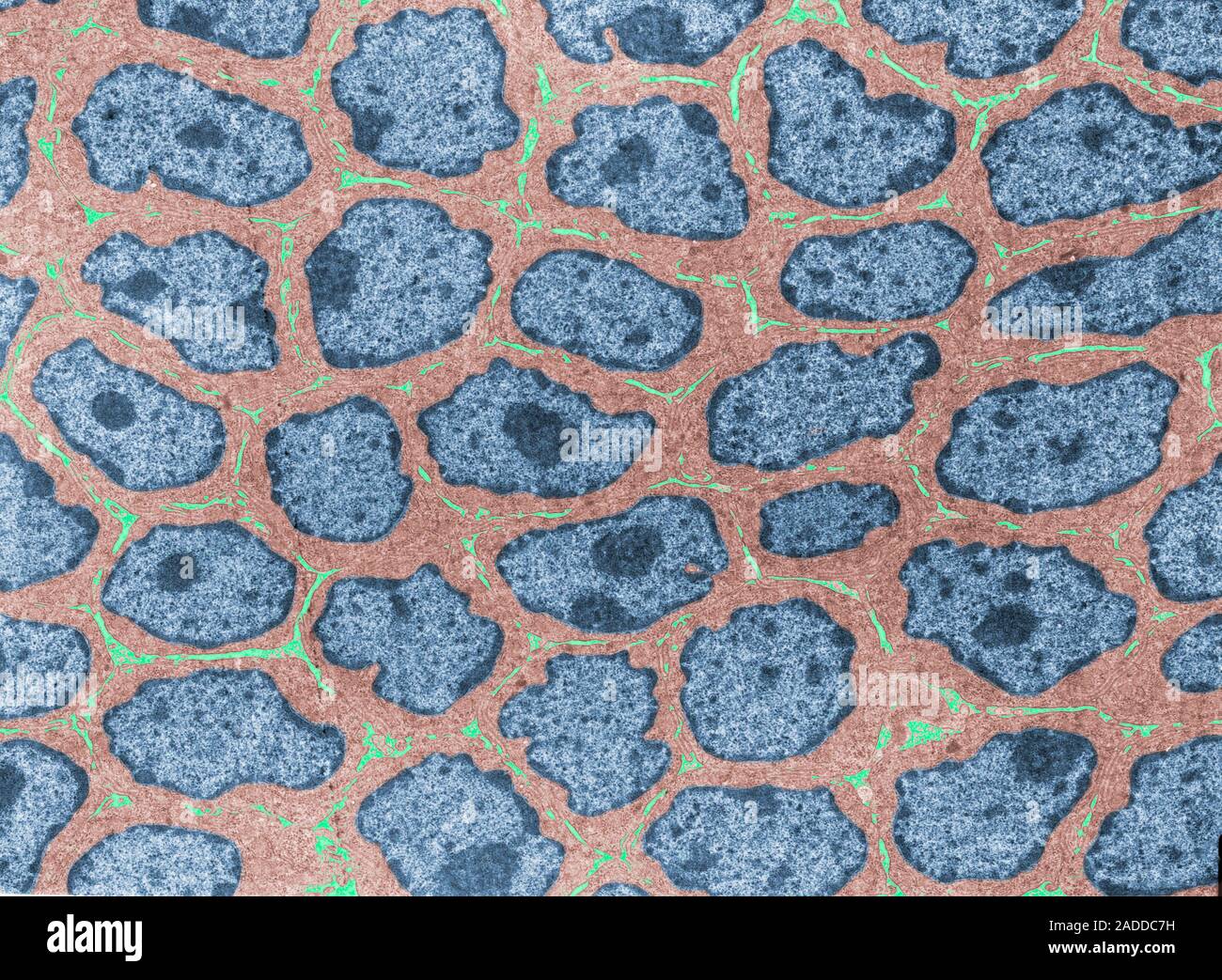 Coloured transmission electron micrograph (TEM) of a cross section ...