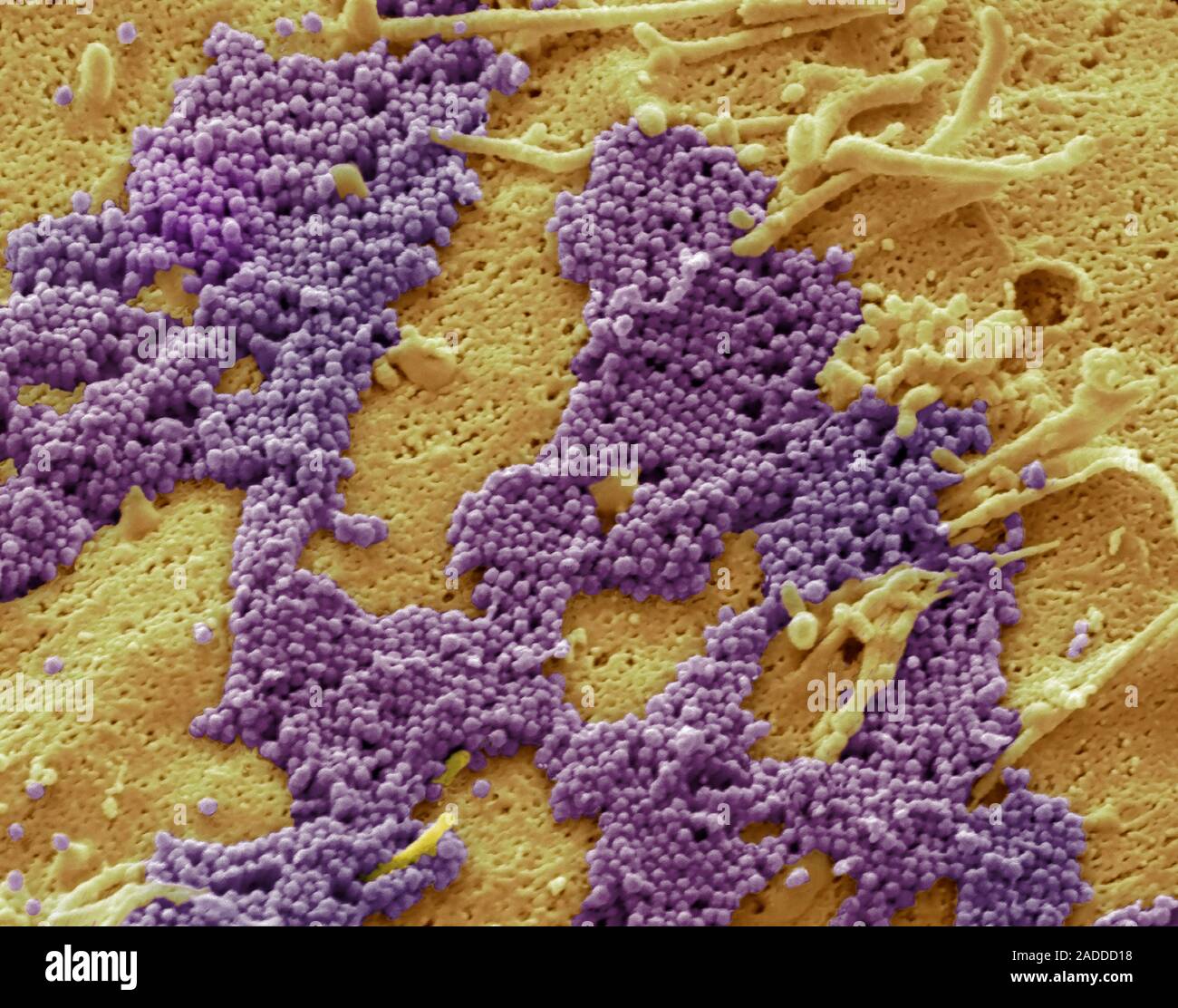 Human cells infected with influenza virus, coloured scanning electron ...