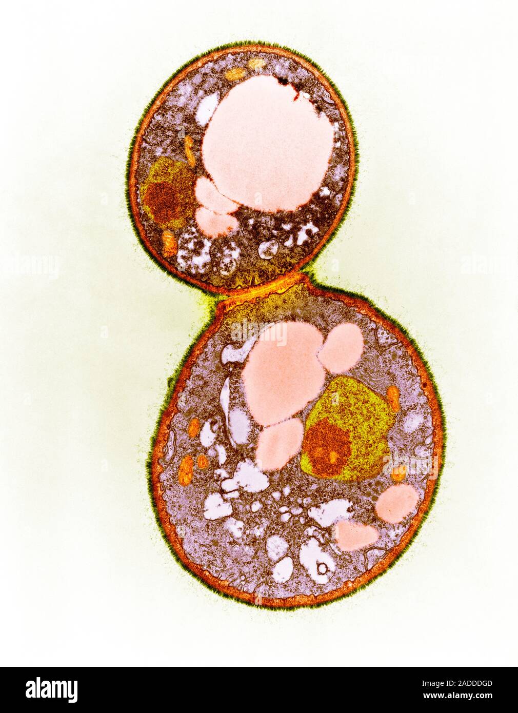 Coloured transmission electron micrograph (TEM) of a freeze-fracture ...