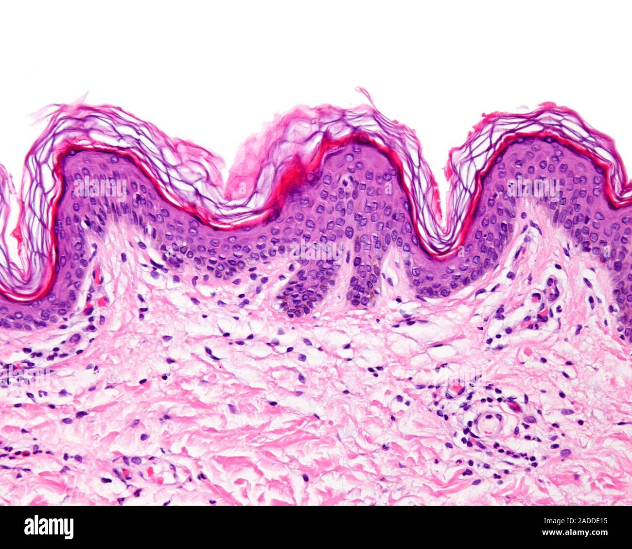 Skin epidermis, light micrograph. The epidermis is the outer layer of ...