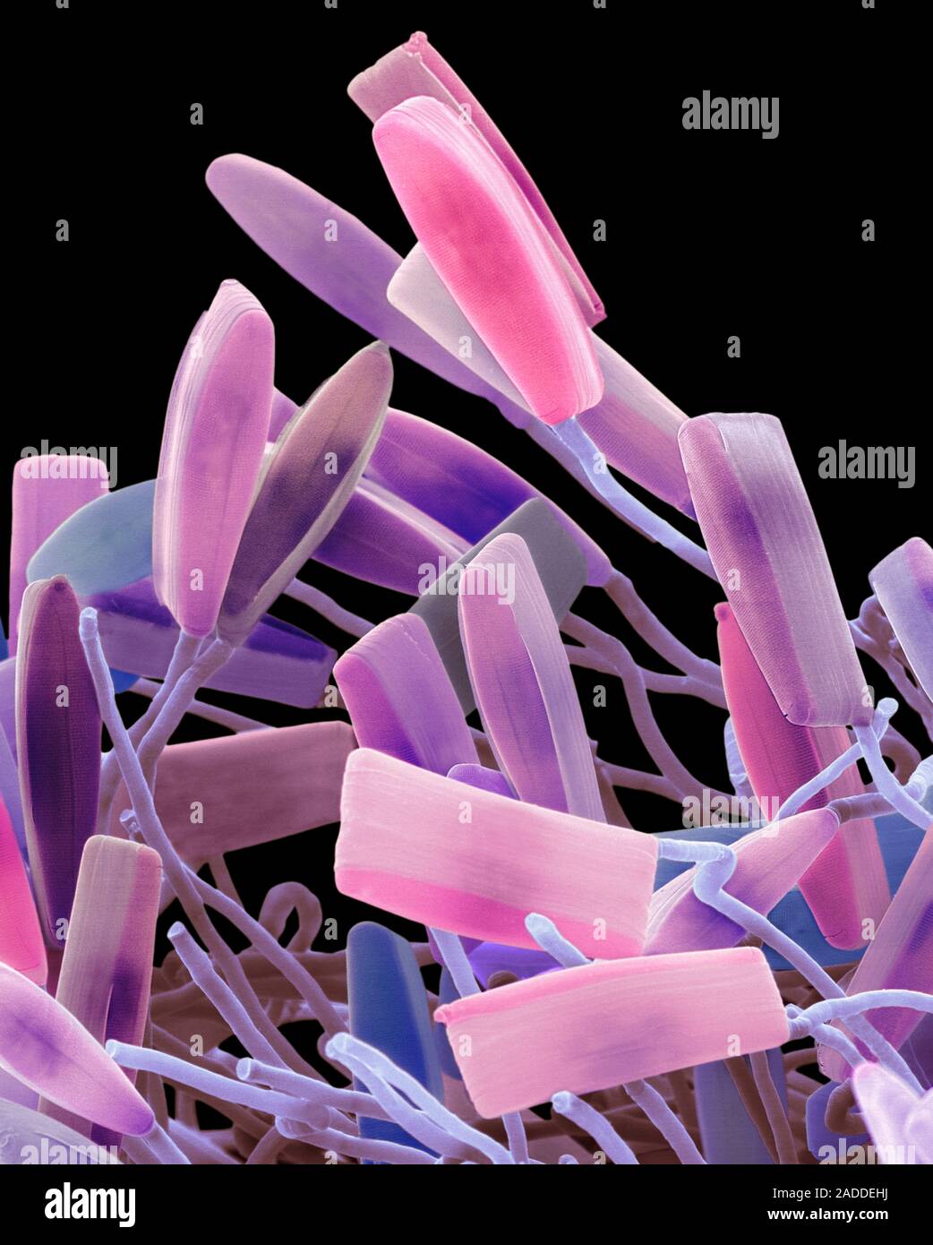 Coloured scanning electron micrograph (SEM) of marine pennate diatoms ...