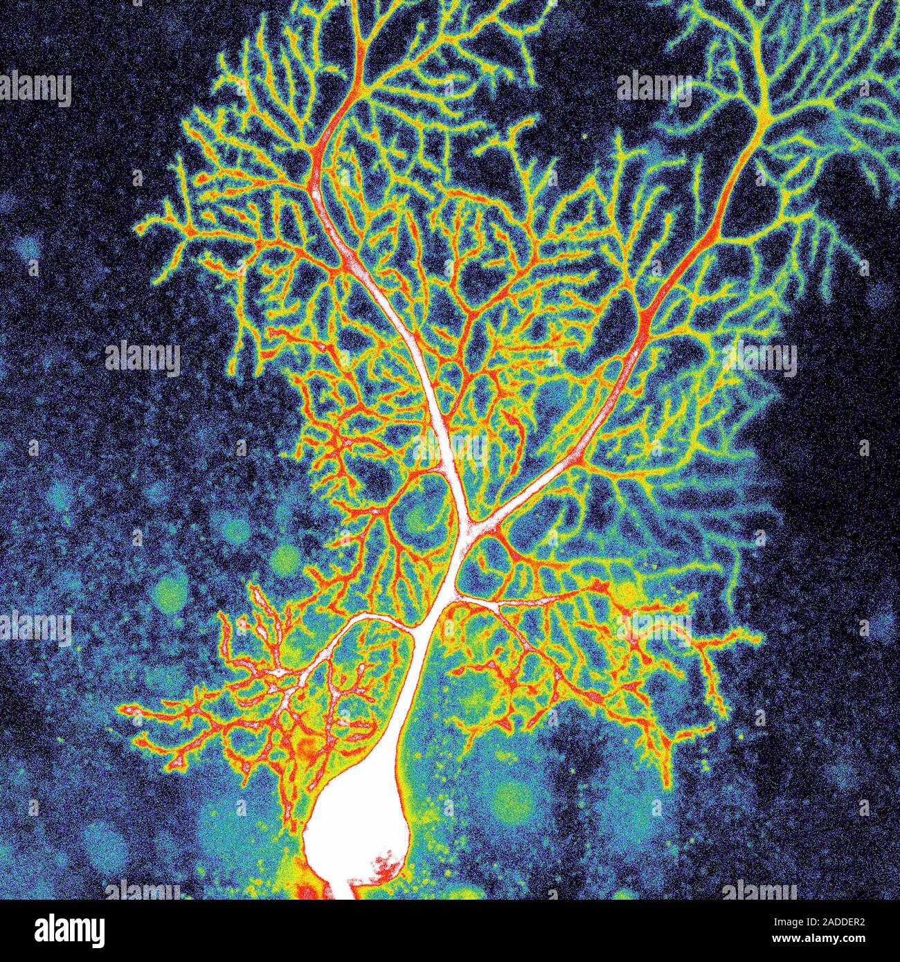 Coloured confocal light micrograph of a Purkinje neuron (nerve cell ...
